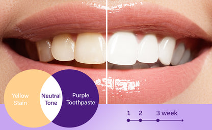 Blanqueador Dental Morada v34