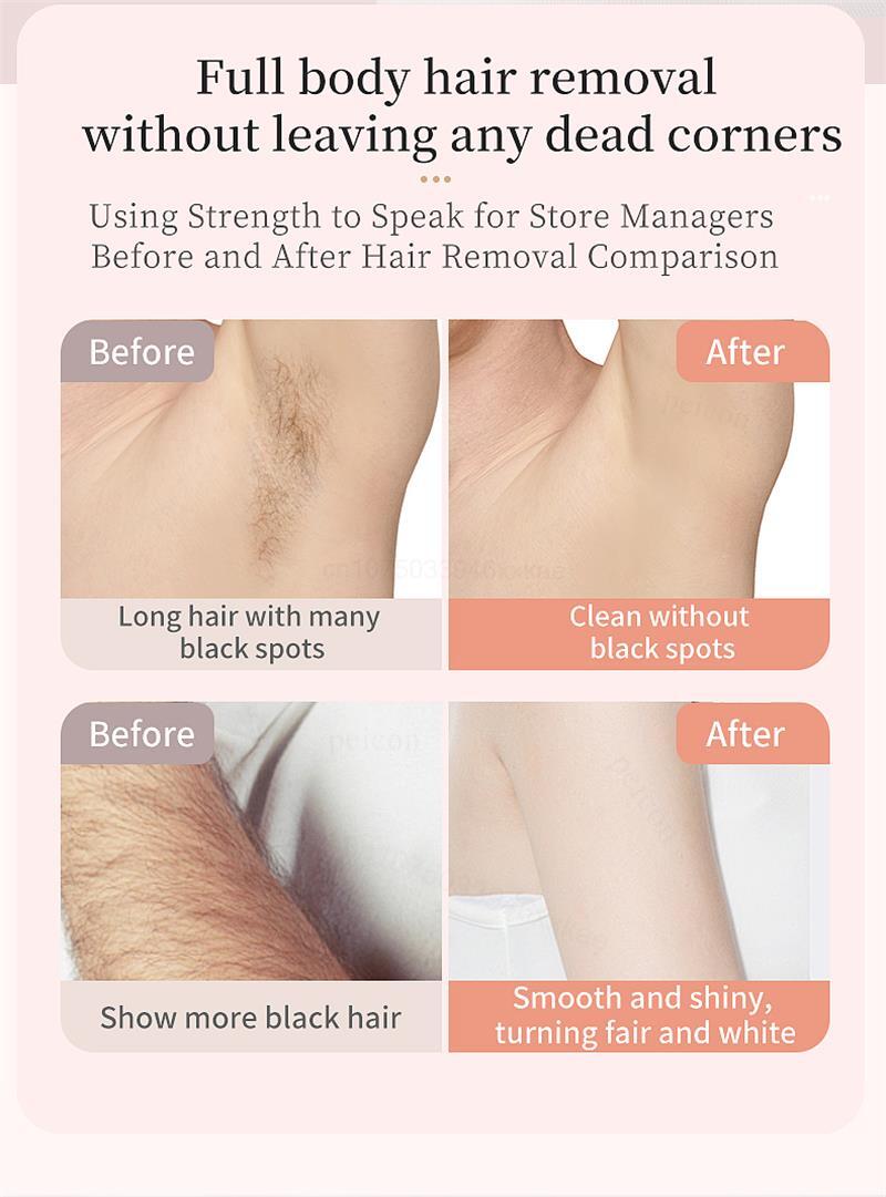 Depiladora portátil con doble cabezal